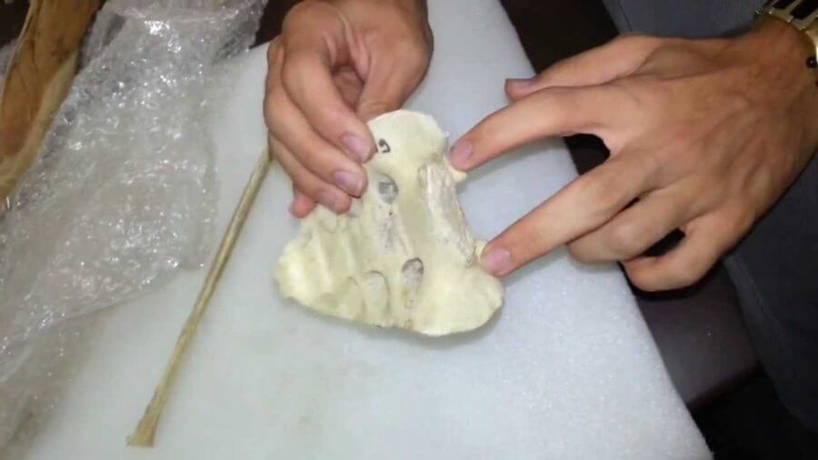 اخبار پزشکی,خبرهای پزشکی,تازه های پزشکی,سرطان سینه