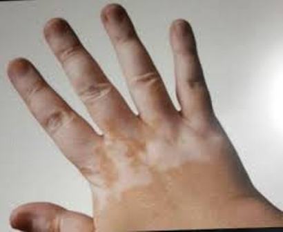 پوست،اختراعات و پژوهش،خبرهای علمی،اخبار علمی اخبار علمی,خبرهای علمی,اختراعات و پژوهش,پوست