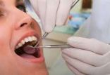 اخبار پزشکی,خبرهای پزشکی,تازه های پزشکی,بیماری لثه