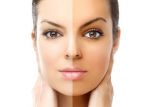 اخبار پزشکی,خبرهای پزشکی,تازه های پزشکی,برنزه شدن پوست
