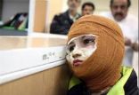 اخبار پزشکی,خبرهای پزشکی,تازه های پزشکی,تولید پانسمان سوختگی