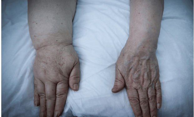 سرطان،مشاوره پزشکی،خبرهای پزشکی،اخبار پزشکی اخبار پزشکی,خبرهای پزشکی,مشاوره پزشکی,سرطان