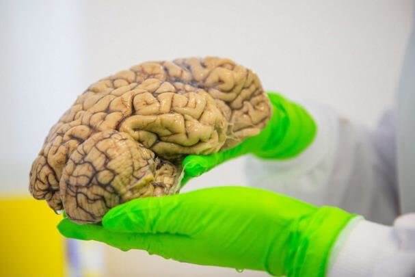 اخبار پزشکی,خبرهای پزشکی,تازه های پزشکی,بانک مغز