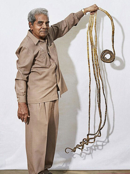 بدن انسان،خواندنی ها و دیدنی ها،خبرهای جالب،اخبار جالب اخبار جالب,خبرهای جالب,خواندنی ها و دیدنی ها,بدن انسان