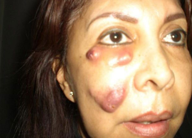 بوتاکس،مشاوره پزشکی،خبرهای پزشکی،اخبار پزشکی اخبار پزشکی,خبرهای پزشکی,مشاوره پزشکی,بوتاکس