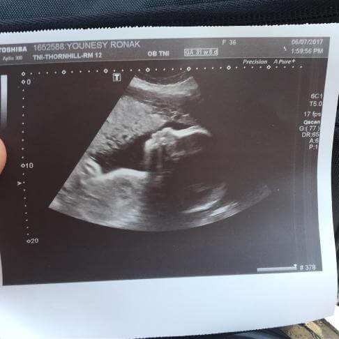 اخبار هنرمندان,خبرهای هنرمندان,بازیگران سینما و تلویزیون,روناک یونسی