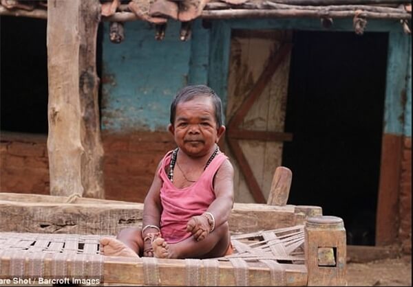 مرد 50 ساله ی 73 سانتی،خواندنی ها و دیدنی ها،خبرهای جالب،اخبار جالب اخبار جالب,خبرهای جالب,خواندنی ها و دیدنی ها,مرد 50 ساله ی 73 سانتی