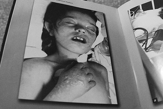 اخبار اجتماعی,خبرهای اجتماعی,جامعه,بمباران سردشت