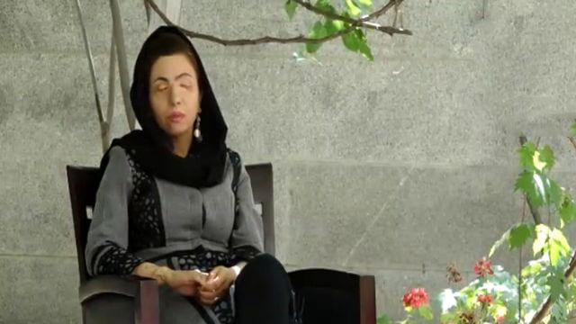 اخبار حوادث,خبرهای حوادث,جرم و جنایت,اسید پاشی