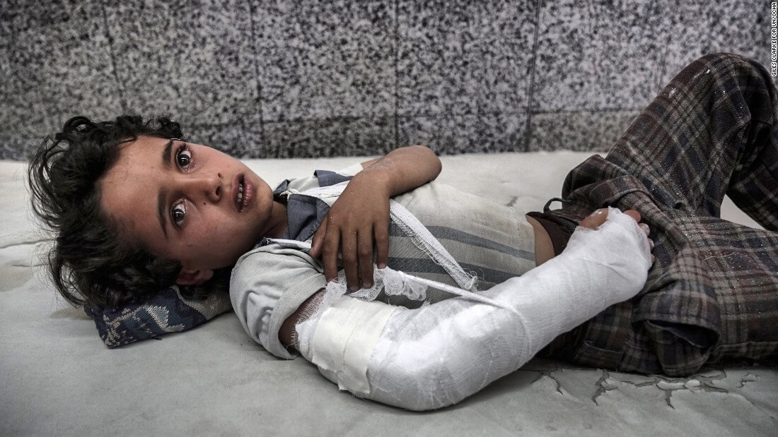 تصاویر وضعیت مردم یمن,تصاویر وضعیت مردم یمن, وضعیت مردم یمن در حملات سعودی ها