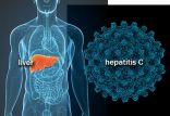 اخبار پزشکی,خبرهای پزشکی,بهداشت,هپاتیت C