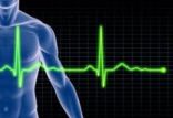 اخبار پزشکی,خبرهای پزشکی,تازه های پزشکی,سکته قلبی