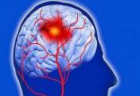 اخبار پزشکی,خبرهای پزشکی,مشاوره پزشکی,عملکرد مغز