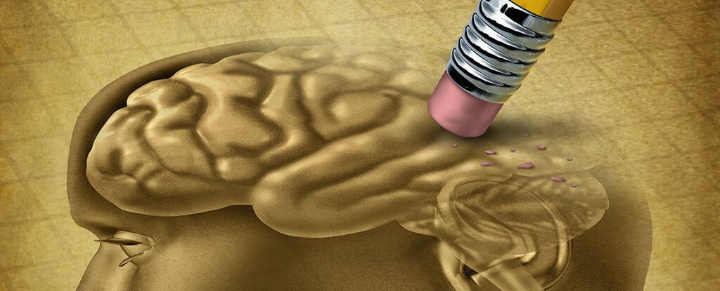 مغز مغز,اخبار پزشکی,خبرهای پزشکی,تازه های پزشکی