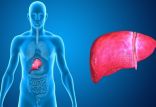 کبد چرب,اخبار پزشکی,خبرهای پزشکی,تازه های پزشکی