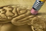 مغز,اخبار پزشکی,خبرهای پزشکی,تازه های پزشکی