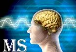 ام اس,اخبار پزشکی,خبرهای پزشکی,تازه های پزشکی