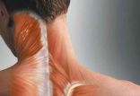 کم کردن سوزش عضلات بعد از ورزش,اخبار پزشکی,خبرهای پزشکی,تازه های پزشکی