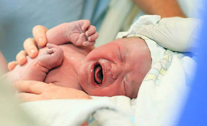 نوزاد تازه متولد شده,اخبار پزشکی,خبرهای پزشکی,بهداشت