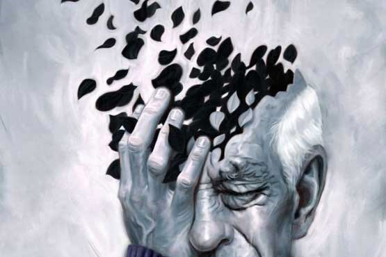 زوال عقل زوال عقل,اخبار پزشکی,خبرهای پزشکی,مشاوره پزشکی