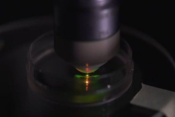 جراحی سلول های سرطانی,اخبار پزشکی,خبرهای پزشکی,تازه های پزشکی