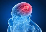 مغز,اخبار پزشکی,خبرهای پزشکی,تازه های پزشکی