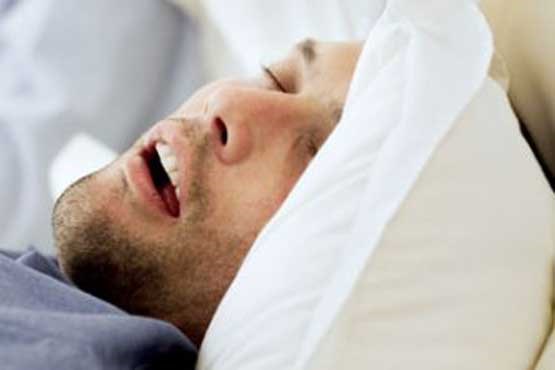 آپنه انسدادی,اخبار پزشکی,خبرهای پزشکی,مشاوره پزشکی