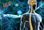 ام اس,اخبار پزشکی,خبرهای پزشکی,تازه های پزشکی