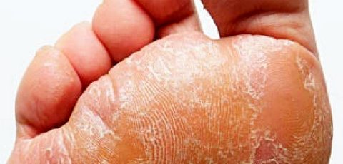 پوشیدن کفش بدون جوراب پوشیدن کفش بدون جوراب,اخبار پزشکی,خبرهای پزشکی,مشاوره پزشکی