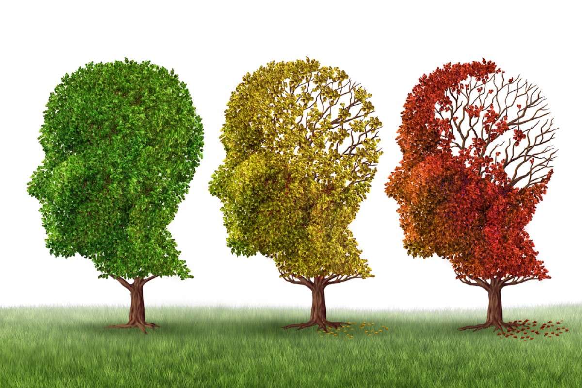 آلزایمر آلزایمر,اخبار پزشکی,خبرهای پزشکی,مشاوره پزشکی