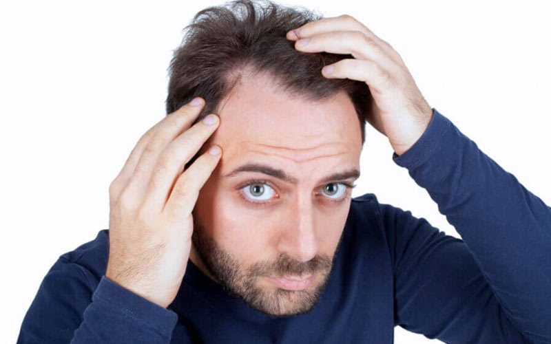 شکننده شدن تارهای مو شکننده شدن تارهای مو,اخبار پزشکی,خبرهای پزشکی,مشاوره پزشکی