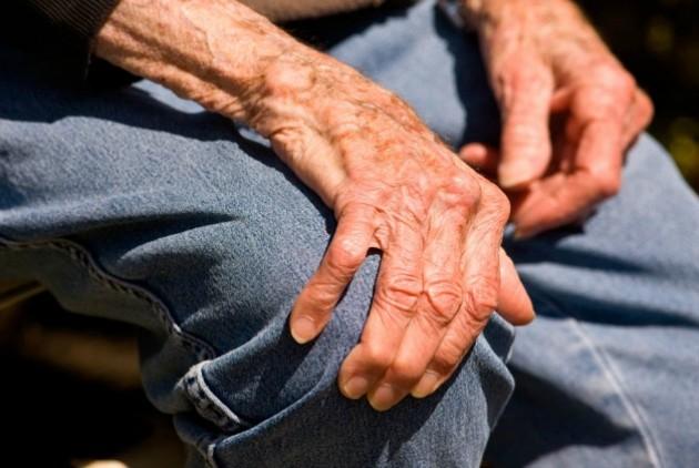 آرتروز آرتروز,اخبار پزشکی,خبرهای پزشکی,مشاوره پزشکی