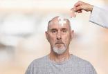 بیماری آلزایمر,اخبار پزشکی,خبرهای پزشکی,تازه های پزشکی