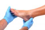 قانقاریا,اخبار پزشکی,خبرهای پزشکی,مشاوره پزشکی