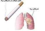 سرطان ریه,اخبار پزشکی,خبرهای پزشکی,تازه های پزشکی