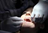 بیماری‌های لثه,اخبار پزشکی,خبرهای پزشکی,تازه های پزشکی