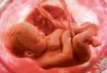 نجات از معلولیت با جراحی ترمیمی جنین در رحم مادر,اخبار پزشکی,خبرهای پزشکی,تازه های پزشکی