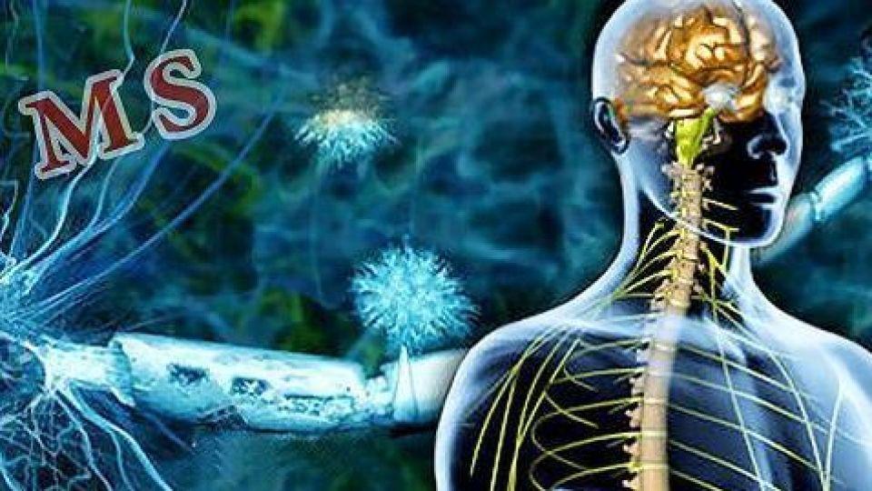 روش های تشخیص ام اس روش های تشخیص ام اس,اخبار پزشکی,خبرهای پزشکی,تازه های پزشکی