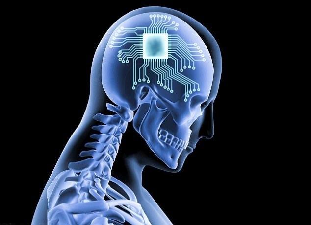 ایمپلنت مغزی,اخبار پزشکی,خبرهای پزشکی,تازه های پزشکی