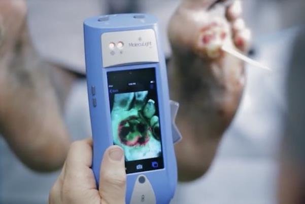 دستگاه MolecuLight دستگاه MolecuLight,اخبار پزشکی,خبرهای پزشکی,تازه های پزشکی