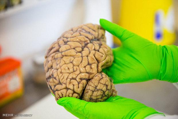 مغز انسان مغز انسان,اخبار پزشکی,خبرهای پزشکی,تازه های پزشکی