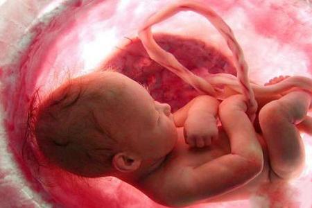 جنین,اخبار اجتماعی,خبرهای اجتماعی,خانواده و جوانان