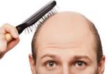 برس مویی,اخبار پزشکی,خبرهای پزشکی,مشاوره پزشکی