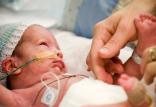 کودکان نارس,اخبار پزشکی,خبرهای پزشکی,تازه های پزشکی