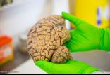 مغز انسان,اخبار پزشکی,خبرهای پزشکی,تازه های پزشکی