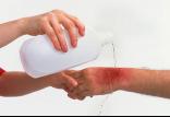 سوختگی,اخبار پزشکی,خبرهای پزشکی,مشاوره پزشکی