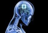 فناوری مغزی,اخبار پزشکی,خبرهای پزشکی,تازه های پزشکی
