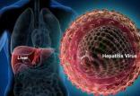 هپاتیت,اخبار پزشکی,خبرهای پزشکی,مشاوره پزشکی