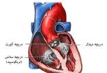 دریچه آئورت,اخبار پزشکی,خبرهای پزشکی,مشاوره پزشکی