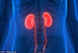 کلیه,اخبار پزشکی,خبرهای پزشکی,تازه های پزشکی